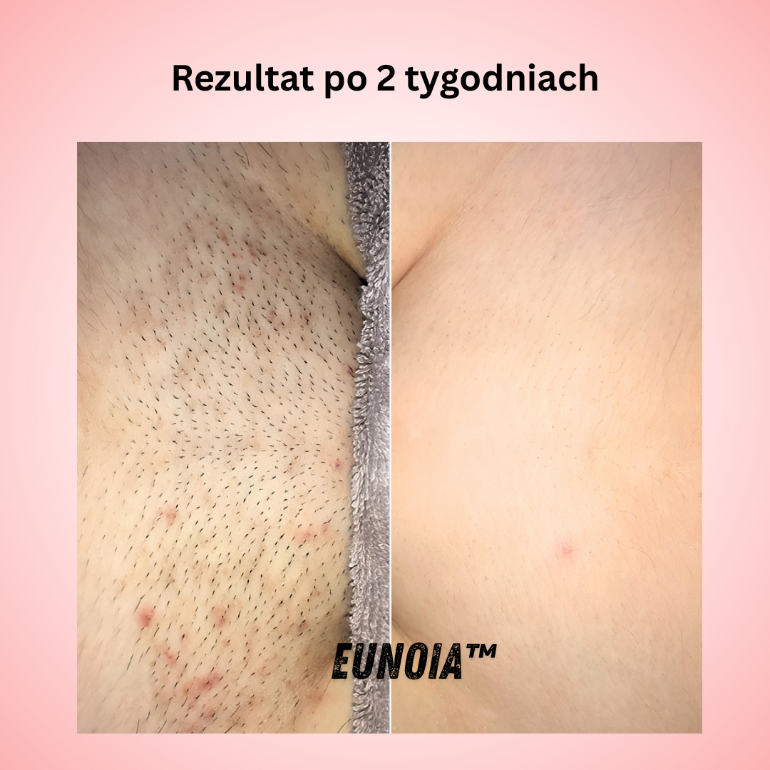 Eunoia Delikatna pielęgnacja wrażliwych okolic