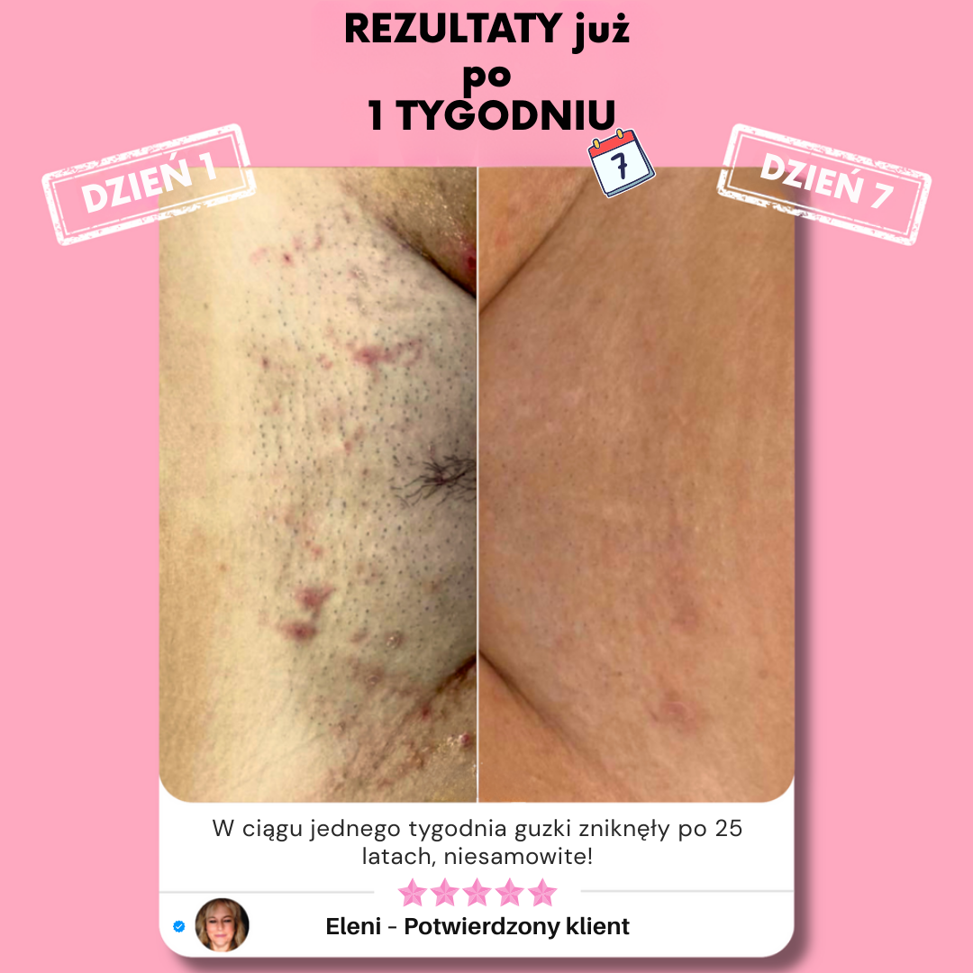 Eunoia Delikatna pielęgnacja wrażliwych okolic